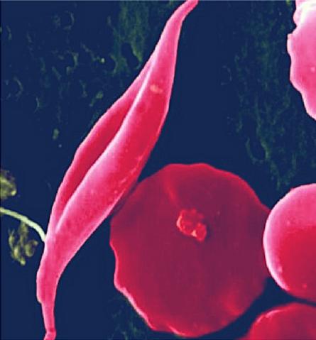 Blood clinical studies