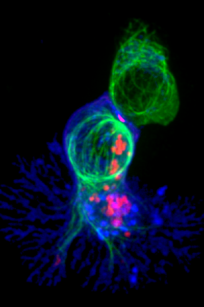 Cancer clinical studies
