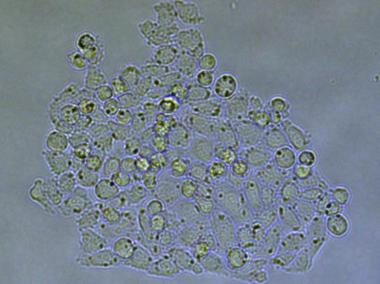 Figure 5.2 Selected colony after 6 days. Credit: Cytosurge