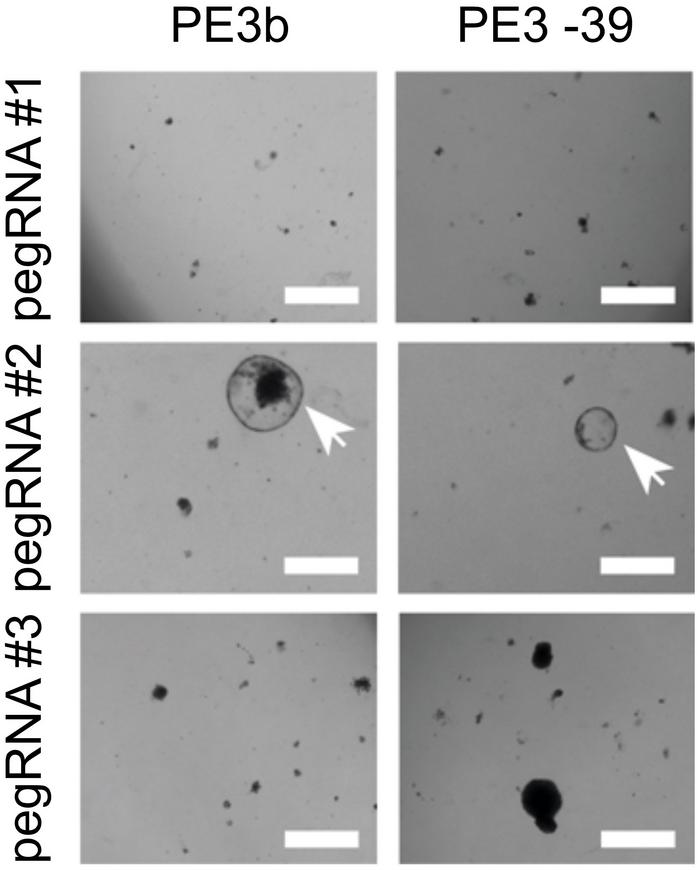 Brightfield images of ATP7BS430fs-patient organoid survival upon exposure to 0.25 mM Cu2+ for 3...