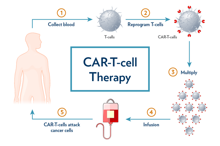 Production of CAR-T Cells. Credit MUSC.