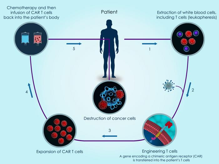 Schematic depicting workflow for autologous CAR T-cell therapy for cancer treatment.