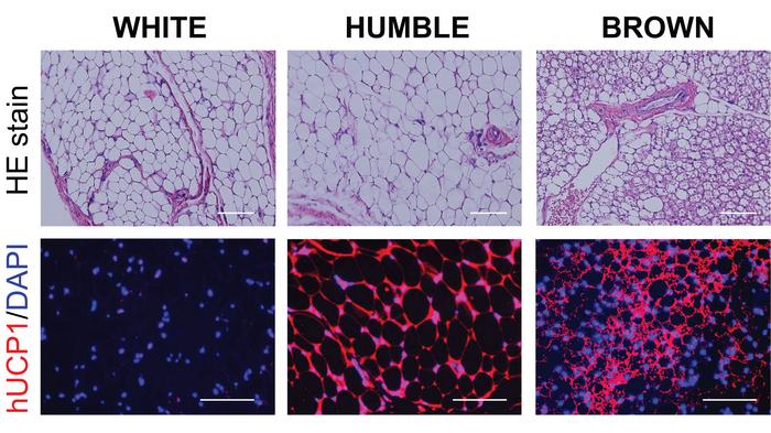 These are microscopic images of the various types of fat tissues developed in mice after...